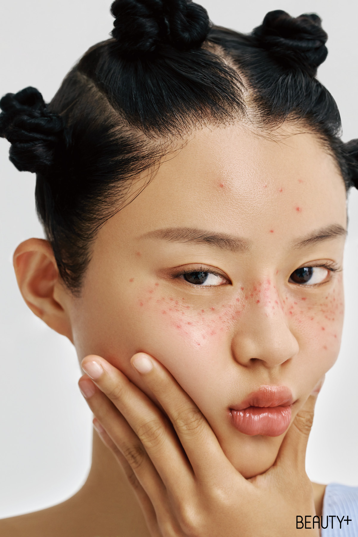 지금 내 피부에 이게 뭐야?